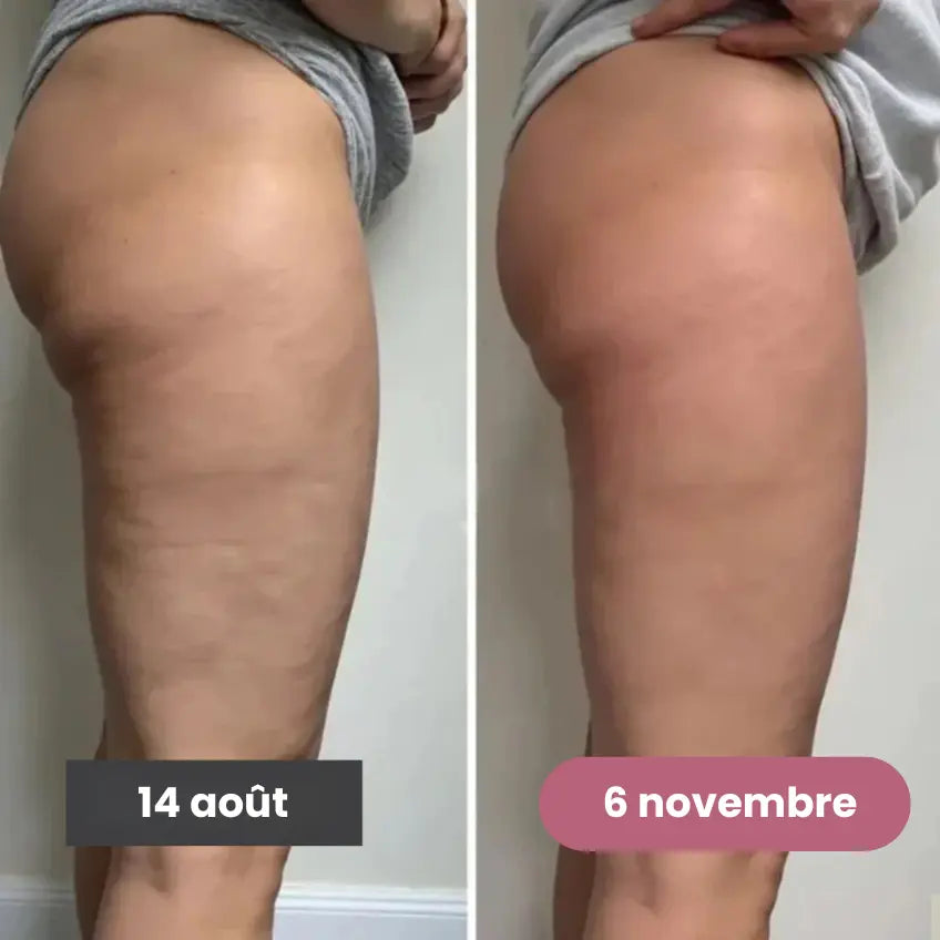 Leggings 3D – Redéfinissez votre silhouette sans effort