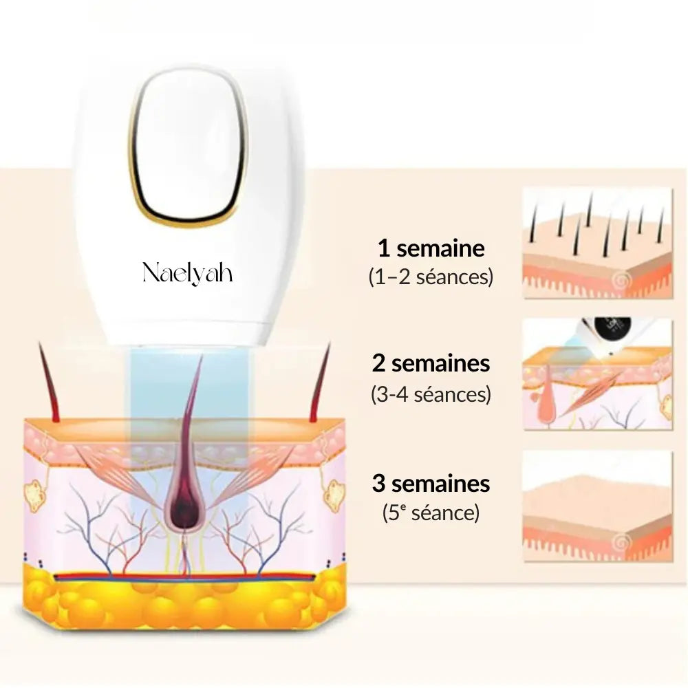 Épilateur IPL Naelyah – Appareil d’élimination des poils