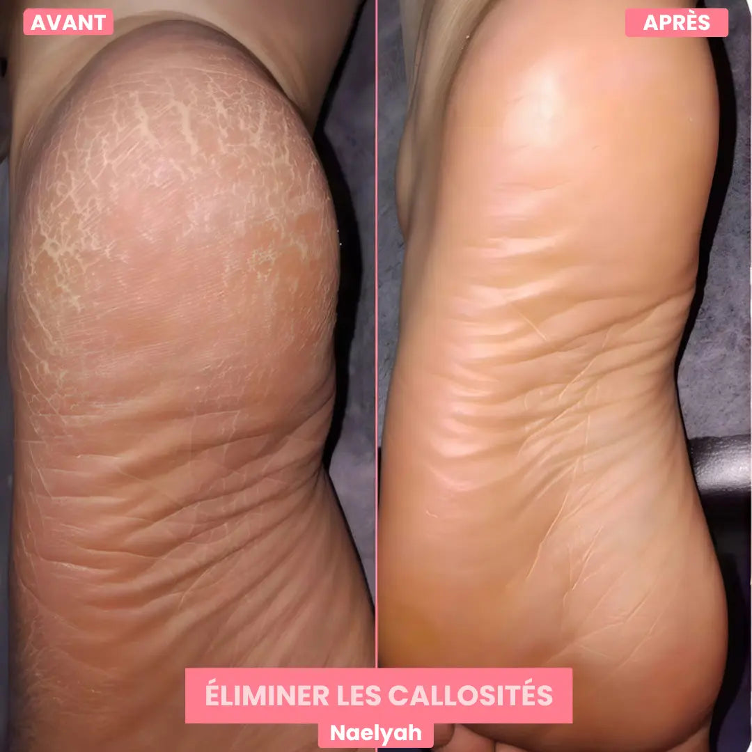 L’ORIGINAL - FootGlow