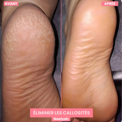 L’ORIGINAL - FootGlow